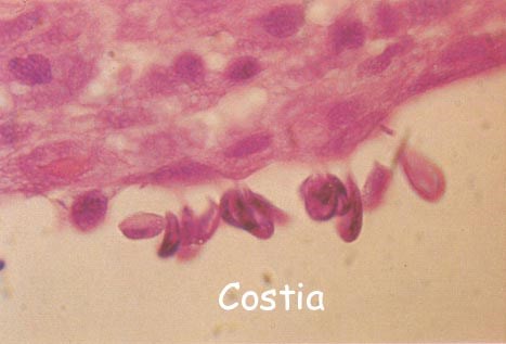 Жгутиконосец Costia necatrix