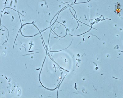 Бактерия Flexibacter columnaris