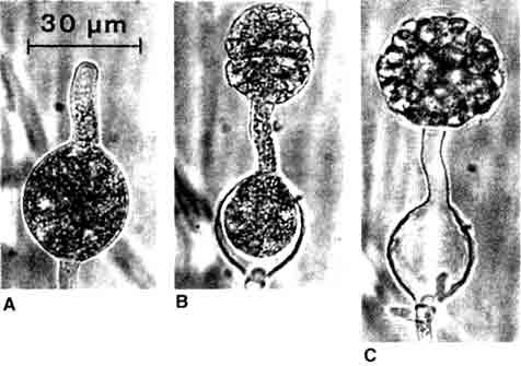  Phythium middletonii: A. Молодой спорангий со спороцистами; B. Спорангий с зародышевым пузырем; C. Зародышевый пузырь содержит зооспоры.