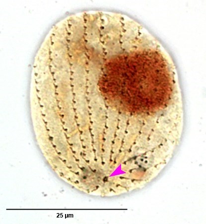 Uronema marinum